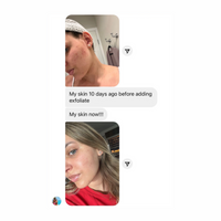 Exfoliant // Face + Body Exfoliator