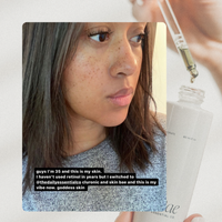 Skin Bae // Face Serum